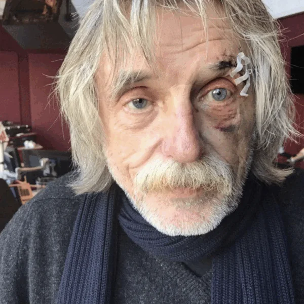 Johan Derksen deelt openhartig nieuws over zijn gezondheid: kijkers reageren massaal