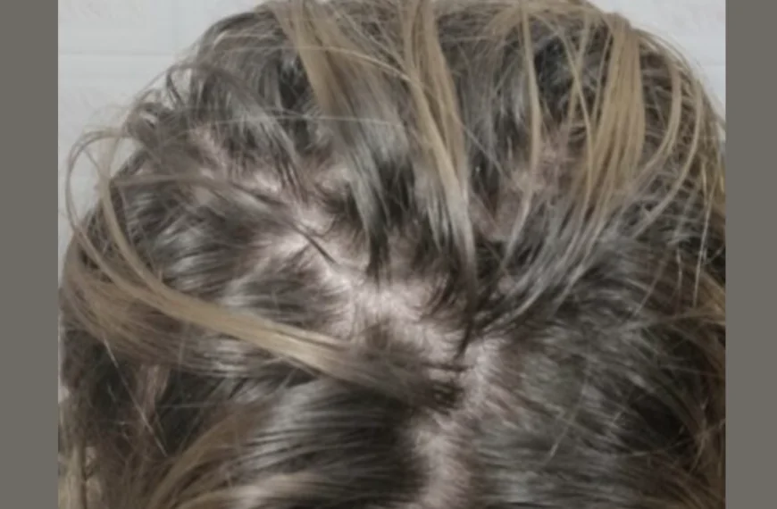 Wat gebeurt er met je haar als je het een week niet wast? Dit is wat experts zeggen