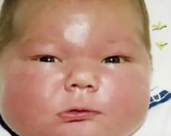 Enorme baby van 7 kilo haalt in 1983 de kranten – en blijft wereldwijd bekend