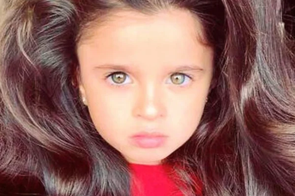 Toen ze vijf was noemden mensen haar het meisje met het mooiste haar – kijk haar nu